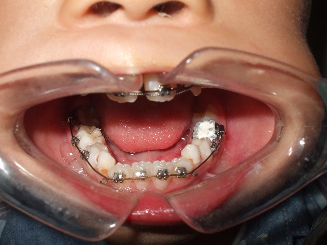 十大外围足球平台app手机版:纪念钱松喦、王朝闻、尹瘦石、古元、石鲁、吴冠中百年诞辰座谈会在京举办(图3) 十大外围足球大平台